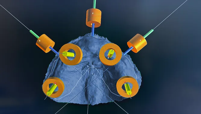 implant surgical guides