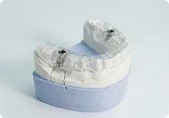 Customized Implant Surgical guides