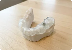 Tooth Supported Guides