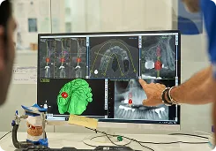CAD/CAM Design Software for Implant surgical guide