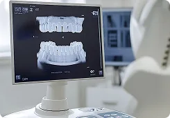 Expert Designed Implant Surgical Guide