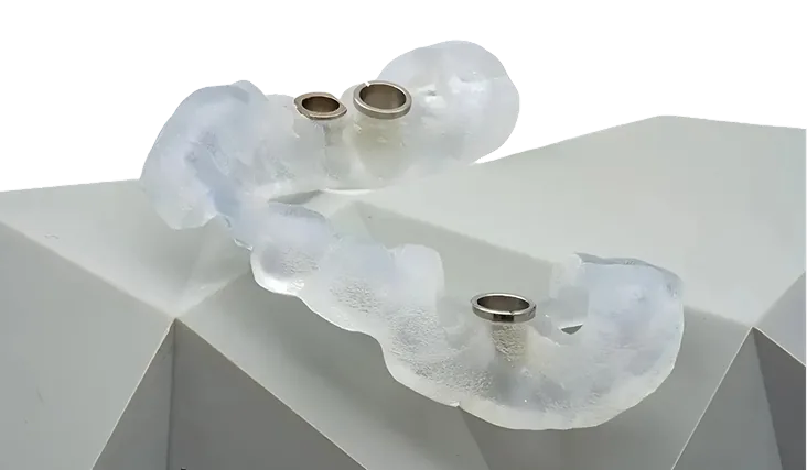 3D Surgery Implant Guides