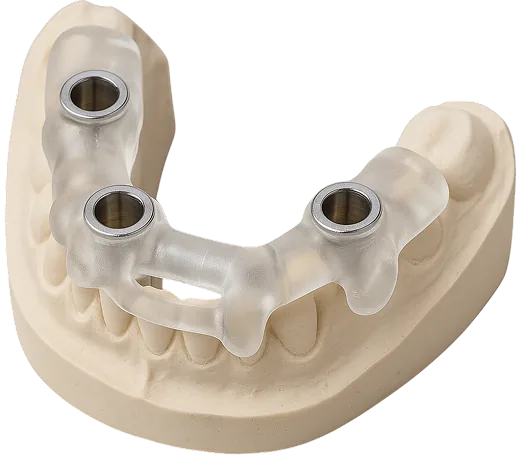 What is Dental Surgical Guide Design?