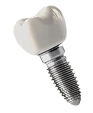 Dental Implant