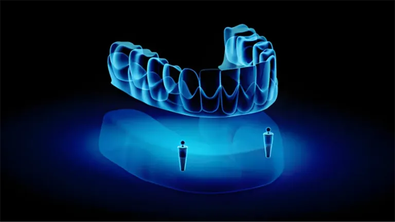 3D Surgical Guide Technology