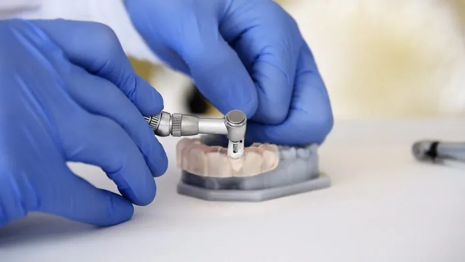 Top 5 Benefits of Using Surgical Guides in Dental Implant Procedures