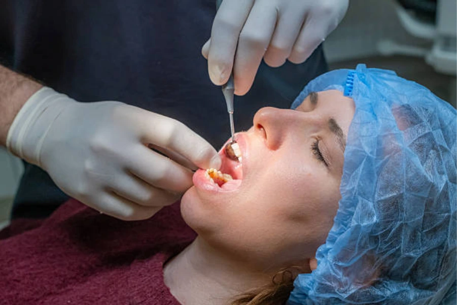 Custom implant surgical guide used during a personalized dental implant procedure for precise placement.
