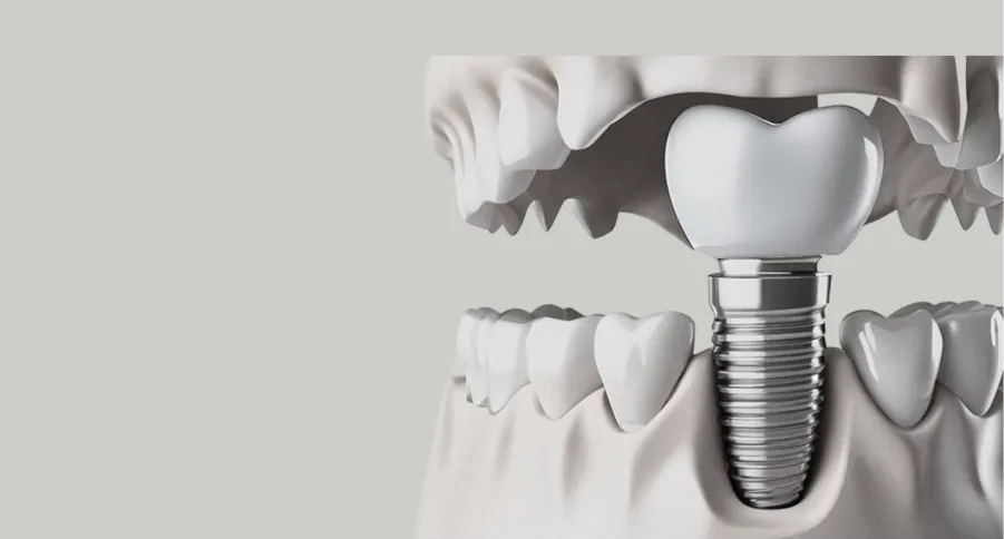 3d printed surgical guide