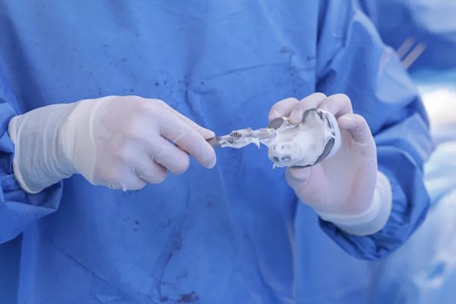 traditional vs digital implant surgical guide