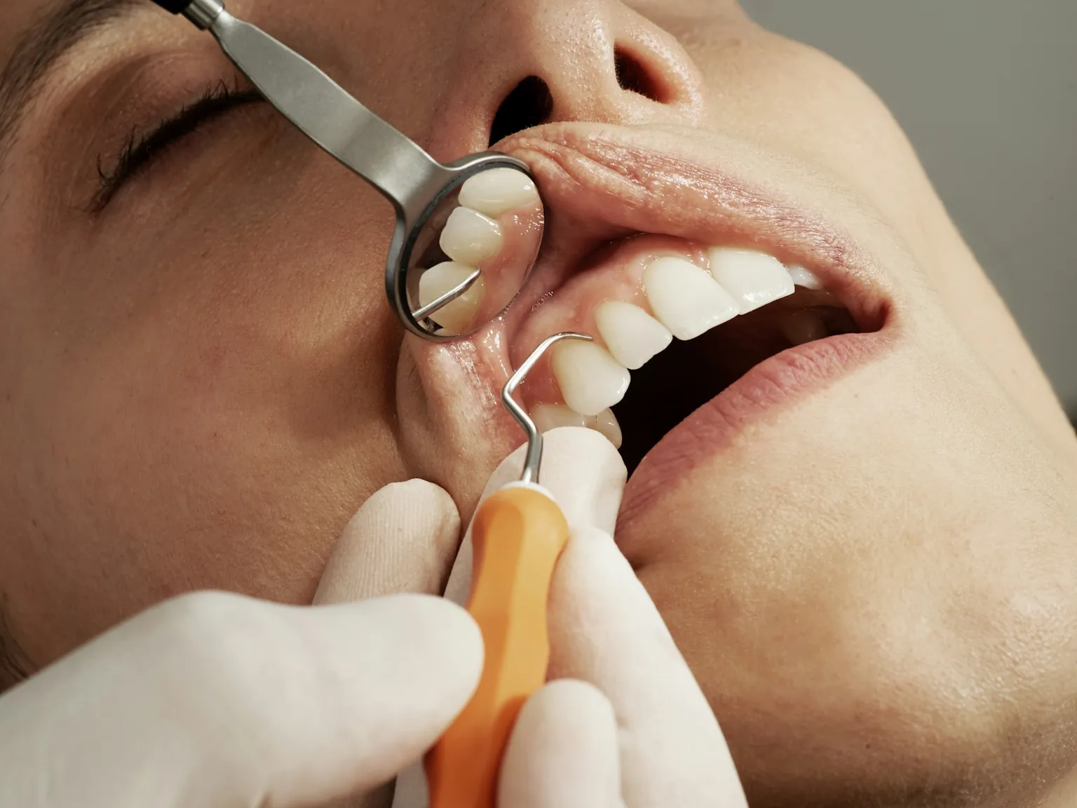 The Evolution of Dental Implantology: How Surgical Guides Are Revolutionizing Procedures
