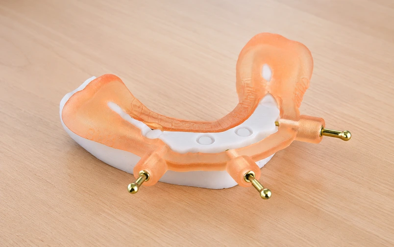 Bone-reduction surgical guide for a full-arch implant case