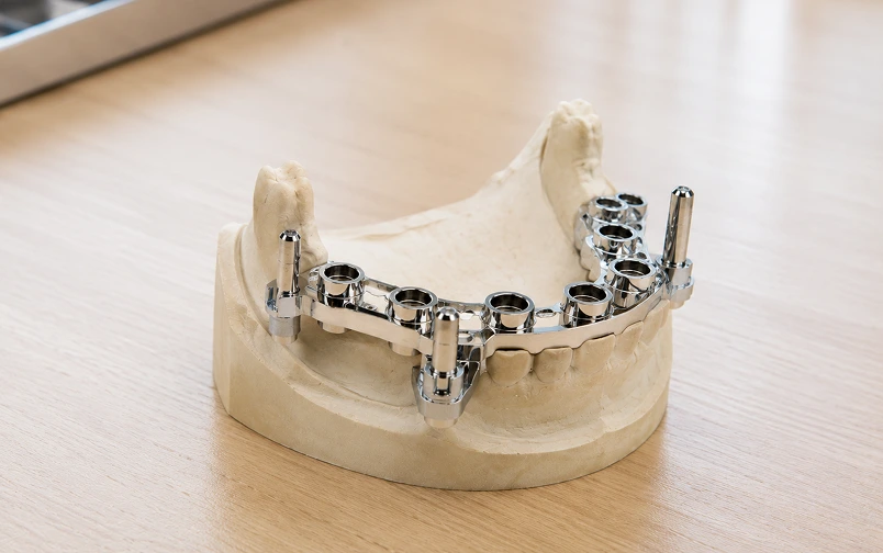 Chrome and metal full-arch surgical guide