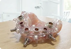 Tooth, bone, mucosa and pin-supported surgical guides