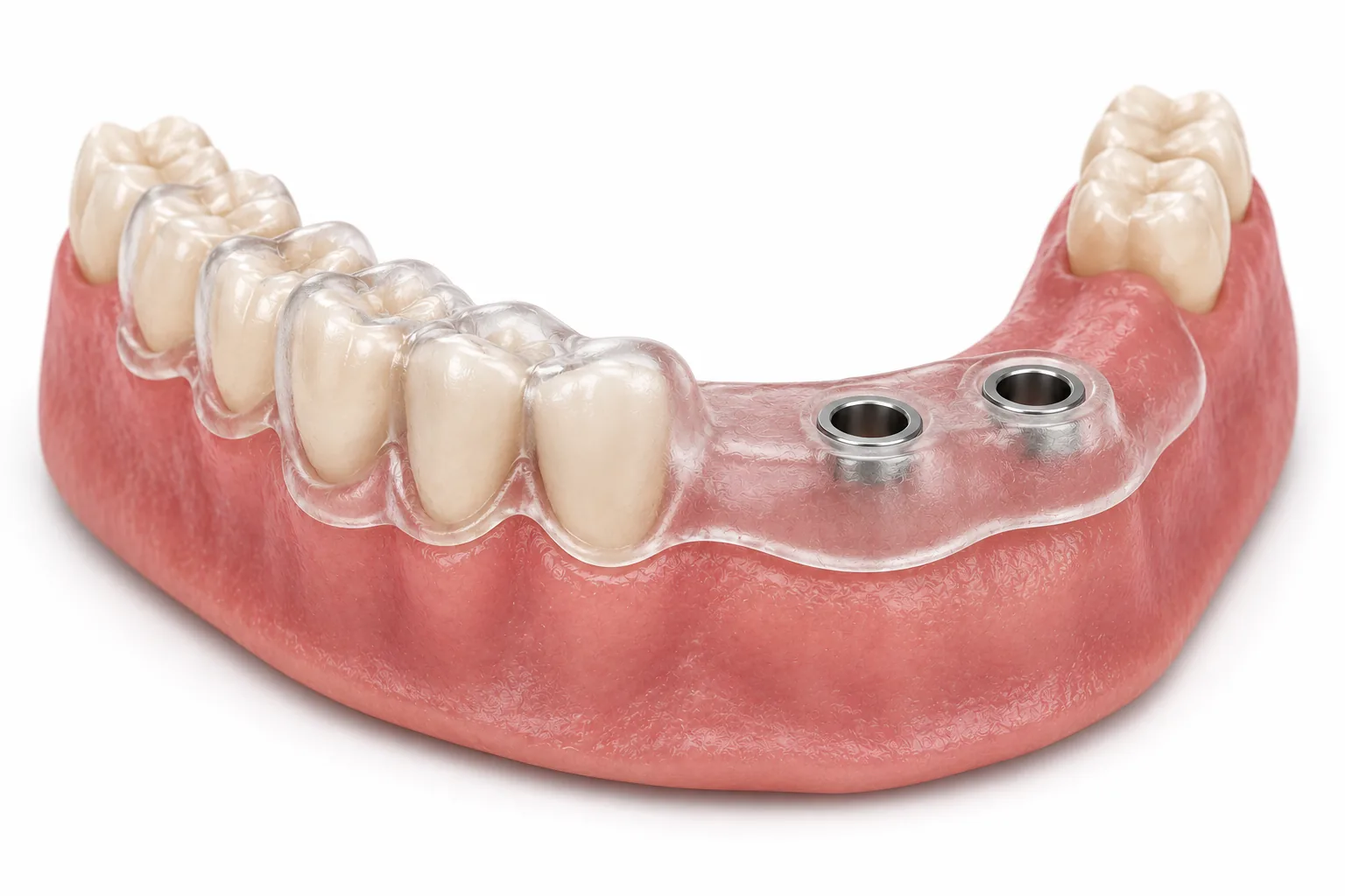 Full-arch all-on-x surgical guide
